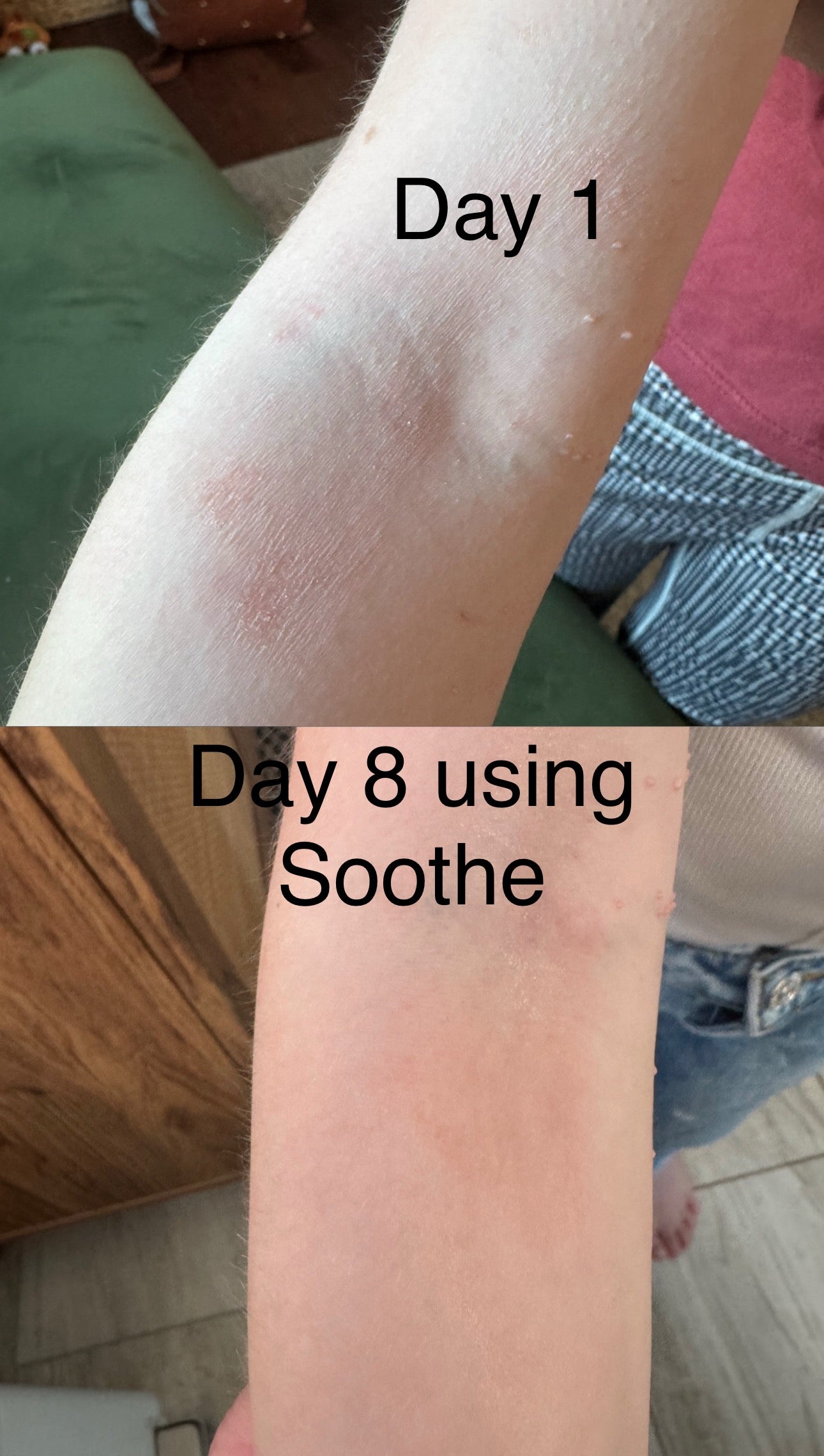 Soothe and Soothe Extra (eczema/skin irritations)