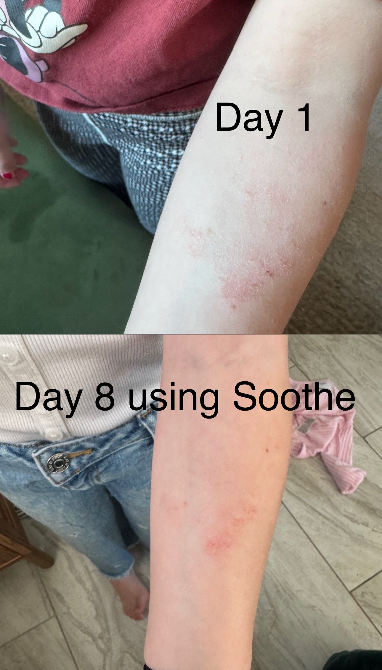 Soothe and Soothe Extra (eczema/skin irritations)